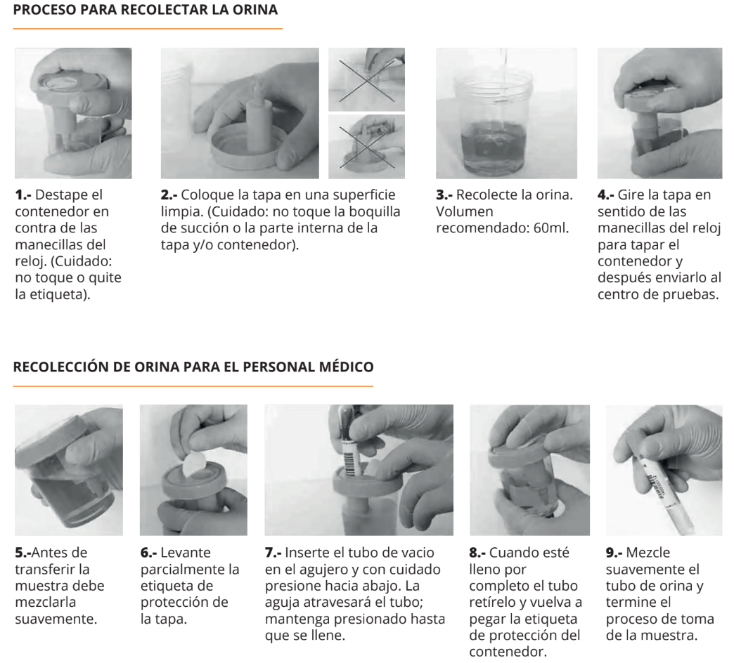 KABLA | Vaso de recolección de orina TransferTop con dispositivo de transferencia integrado,120ml estéril, envuelto individualmente - Caja con 300 piezas