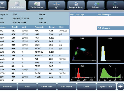 Analizador Hematologico Mindray BC-5150
