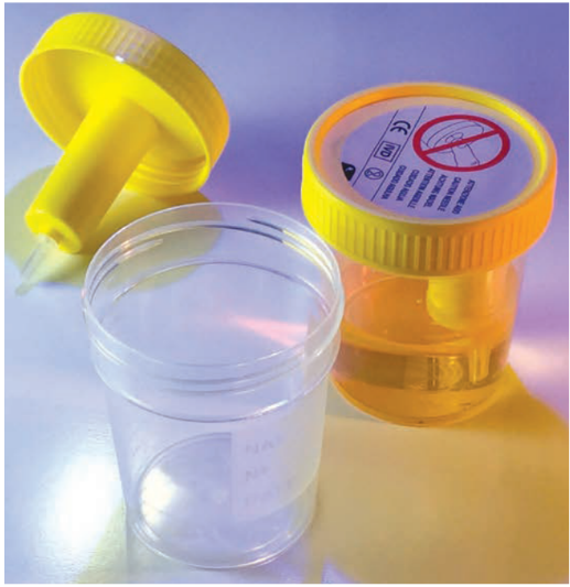 KABLA | Vaso de recolección de orina TransferTop con dispositivo de transferencia integrado,120ml estéril, envuelto individualmente - Caja con 300 piezas