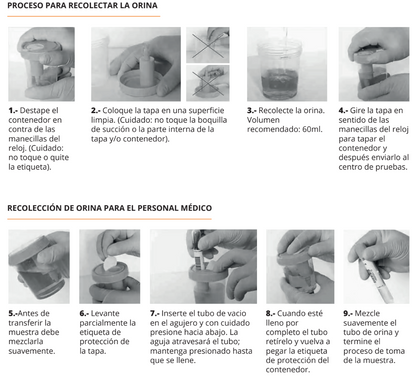 KABLA | Vaso de recolección de orina TransferTop con dispositivo de transferencia integrado,120ml estéril, envuelto individualmente - Caja con 300 piezas