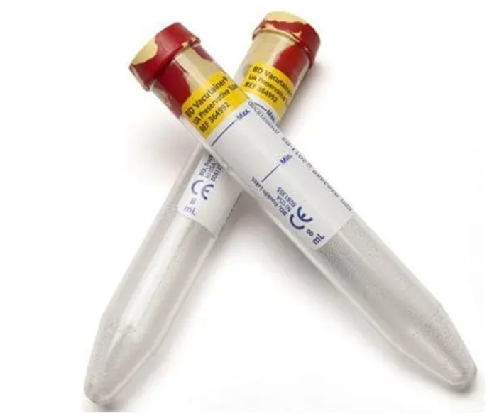 Tubo Marmoleado para uroanálisis con preservador de muestra