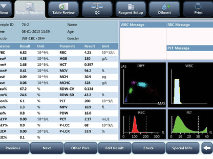 Analizador Hematologico Mindray BC-5150
